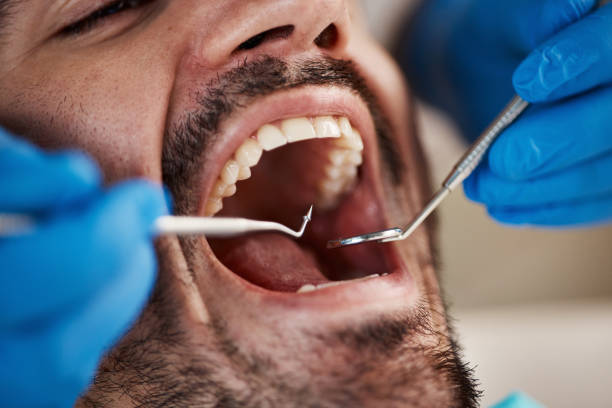 Best Emergency Treatment for Toothache in Staffd, OR